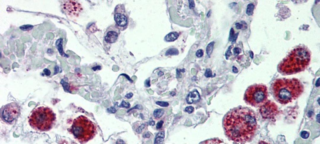 Antibody used in IHC on Human Lung.