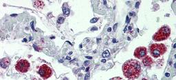 Antibody used in IHC on Human Lung.