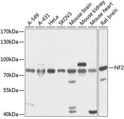 Western blot - NF2 antibody (A13626)