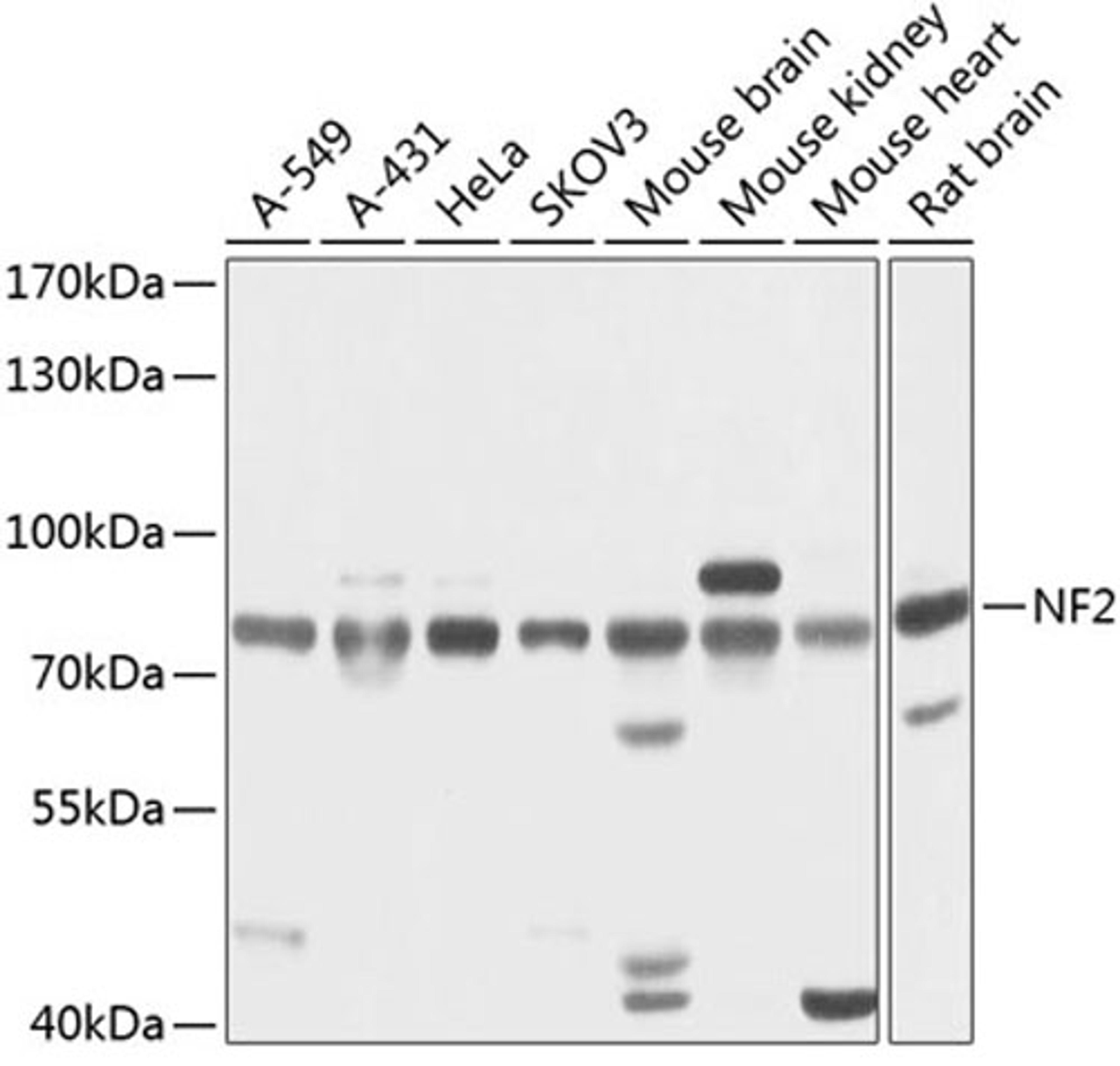 Western blot - NF2 antibody (A13626)