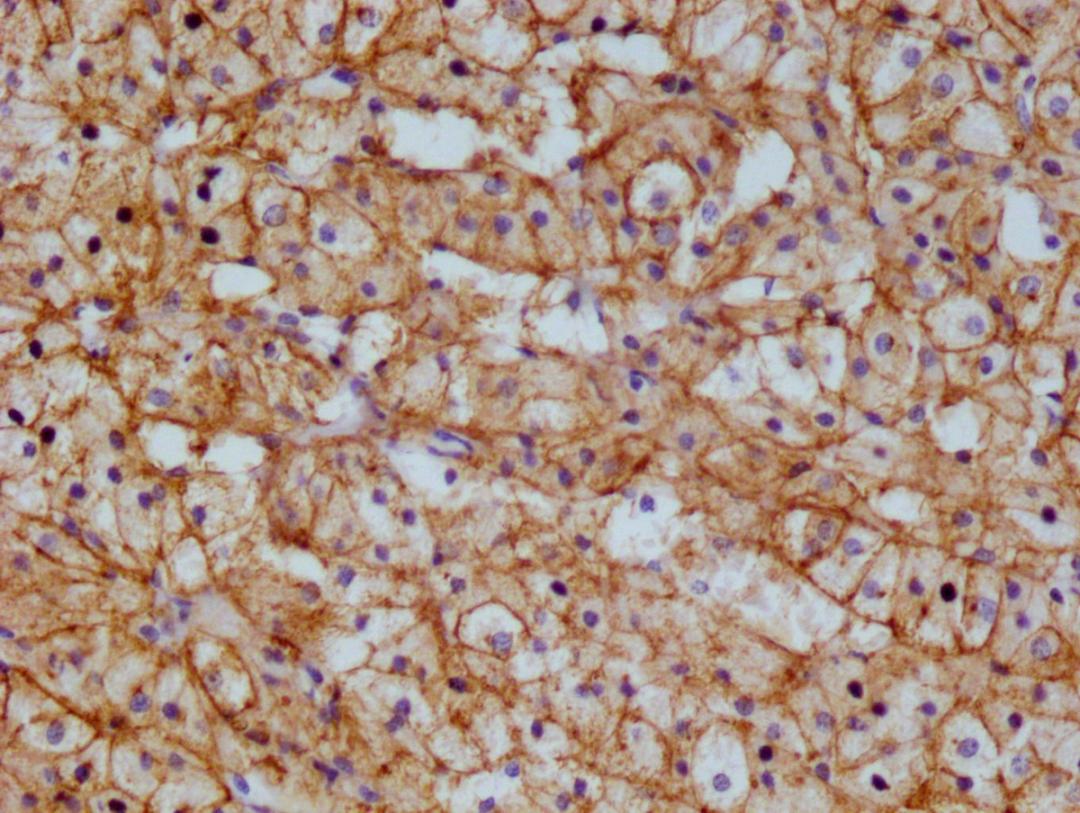 IHC image of CSB-RA983422A0HU diluted at 1:100 and staining in paraffin-embedded  human adrenal gland tissue performed on a Leica BondTM system. After dewaxing and hydration, antigen retrieval was mediated by high pressure in a citrate buffer (pH 6.0). Section was blocked with 10% normal goat serum 30min at RT. Then primary antibody (1% BSA) was incubated at 4°C overnight. The primary is detected by a Goat anti-rabbit polymer IgG labeled by HRP and visualized using 0.05% DAB.