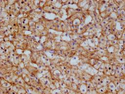 IHC image of CSB-RA983422A0HU diluted at 1:100 and staining in paraffin-embedded  human adrenal gland tissue performed on a Leica BondTM system. After dewaxing and hydration, antigen retrieval was mediated by high pressure in a citrate buffer (pH 6.0). Section was blocked with 10% normal goat serum 30min at RT. Then primary antibody (1% BSA) was incubated at 4°C overnight. The primary is detected by a Goat anti-rabbit polymer IgG labeled by HRP and visualized using 0.05% DAB.