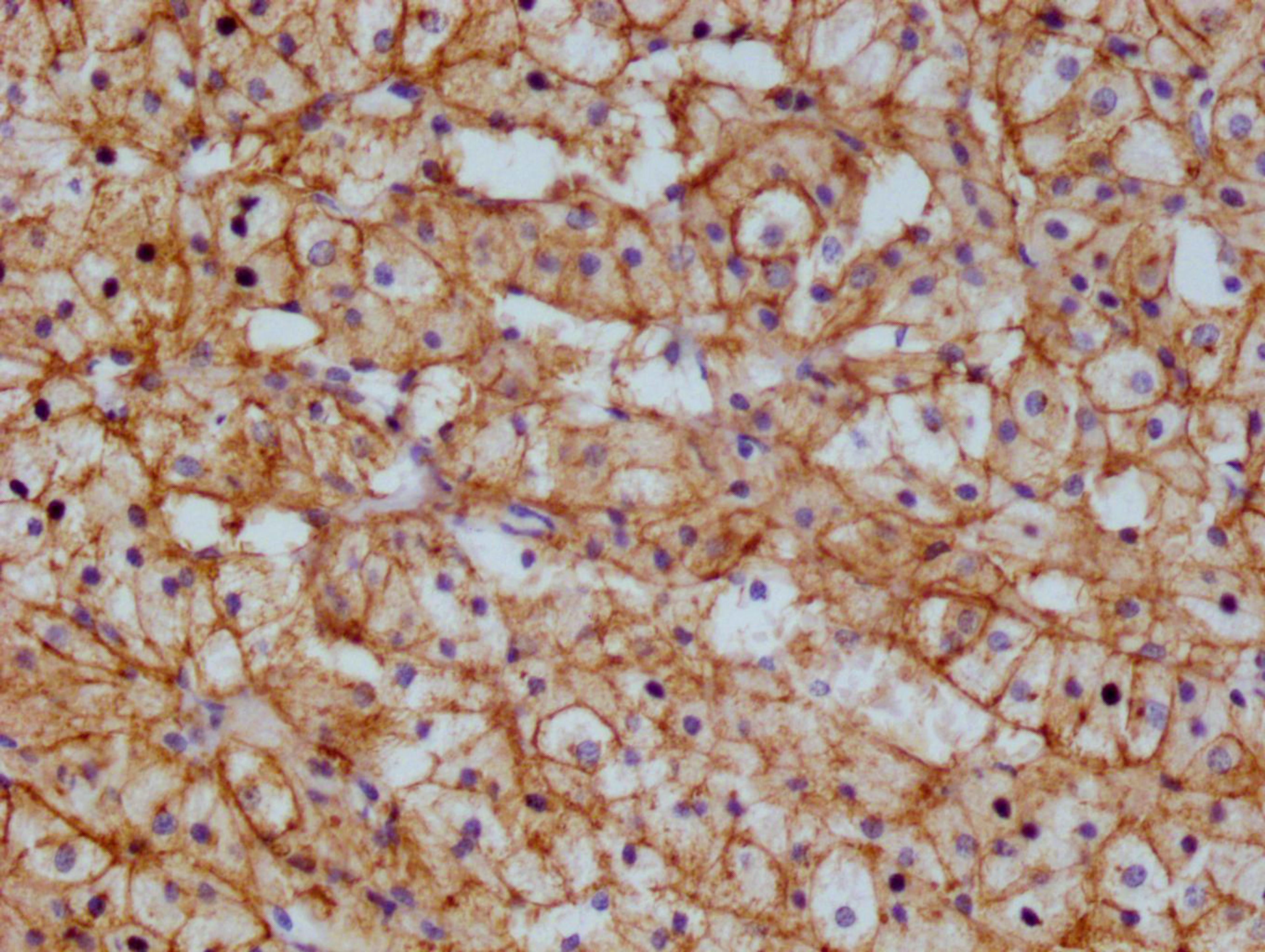 IHC image of CSB-RA983422A0HU diluted at 1:100 and staining in paraffin-embedded  human adrenal gland tissue performed on a Leica BondTM system. After dewaxing and hydration, antigen retrieval was mediated by high pressure in a citrate buffer (pH 6.0). Section was blocked with 10% normal goat serum 30min at RT. Then primary antibody (1% BSA) was incubated at 4°C overnight. The primary is detected by a Goat anti-rabbit polymer IgG labeled by HRP and visualized using 0.05% DAB.