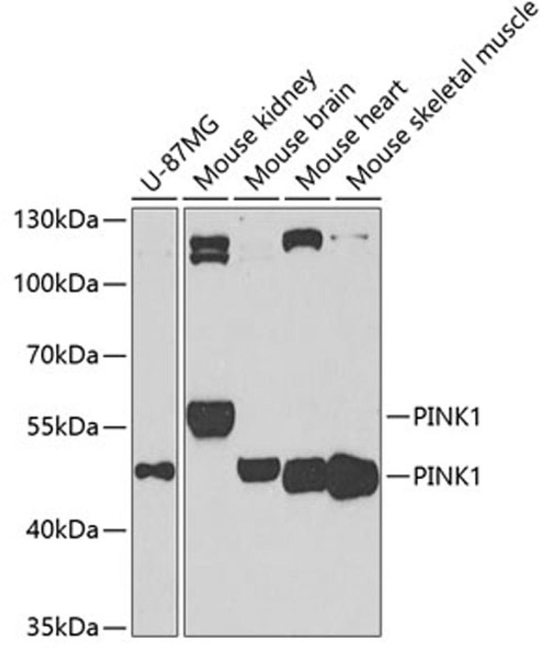 Western blot - PINK1 antibody (A7131)