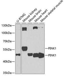 Western blot - PINK1 antibody (A7131)