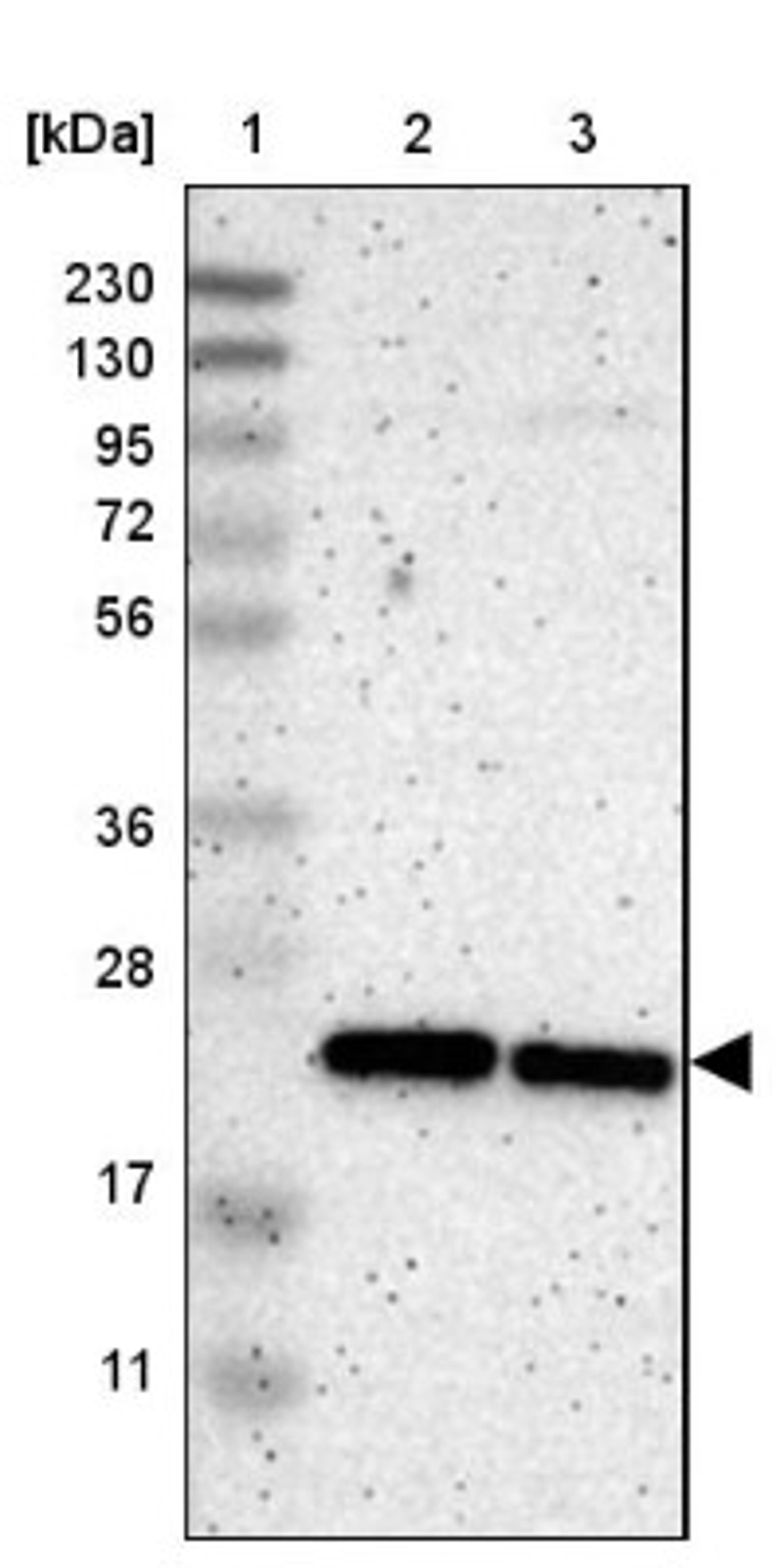 Western Blot: SLC25A48 Antibody [NBP1-81893] - Lane 1: Marker [kDa] 230, 130, 95, 72, 56, 36, 28, 17, 11<br/>Lane 2: Human cell line RT-4<br/>Lane 3: Human cell line U-251MG sp