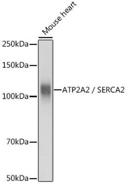 Western blot - ATP2A2 / SERCA2 antibody (A0098)