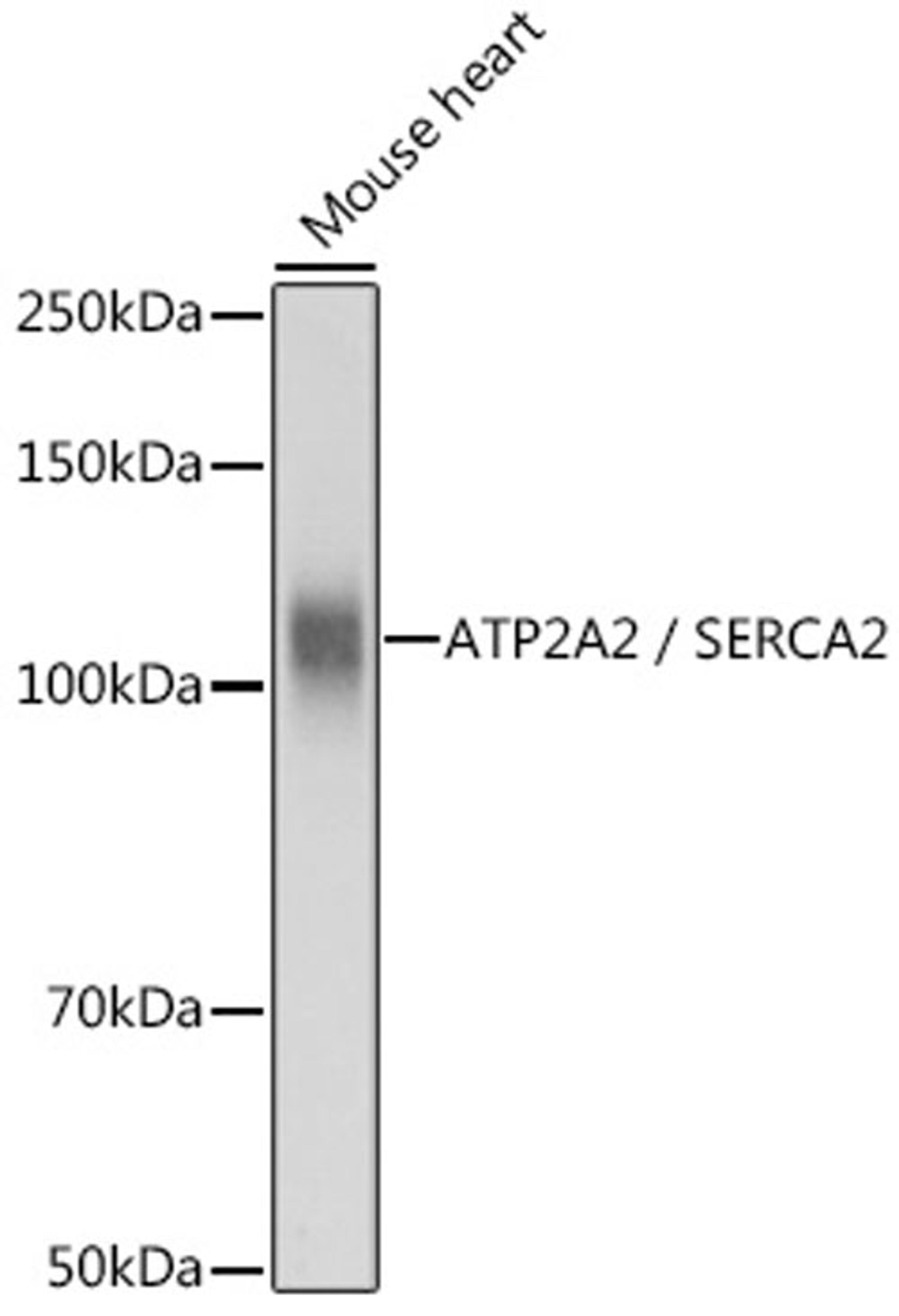 Western blot - ATP2A2 / SERCA2 antibody (A0098)