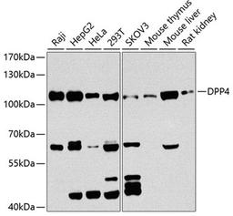 Western blot - DPP4 antibody (A1455)