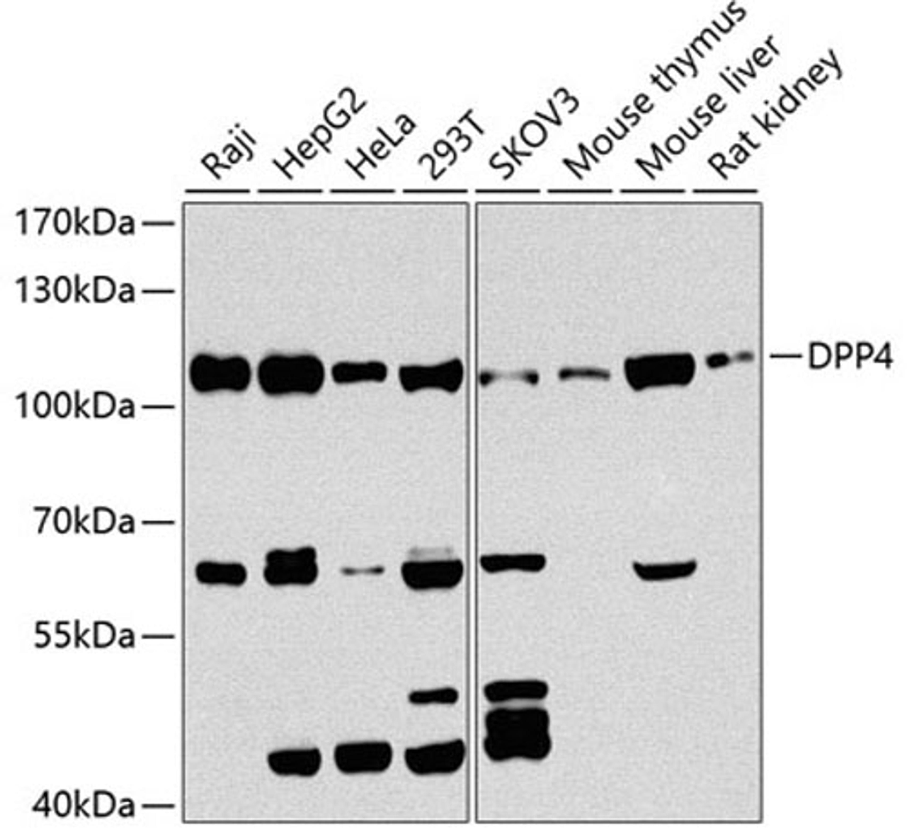 Western blot - DPP4 antibody (A1455)