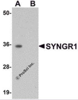Western blot analysis of SYNGR1 in rat brain tissue lysate with SYNGR1 antibody at 1 μg/mL in (A) the absence and (B) the presence of blocking peptide.