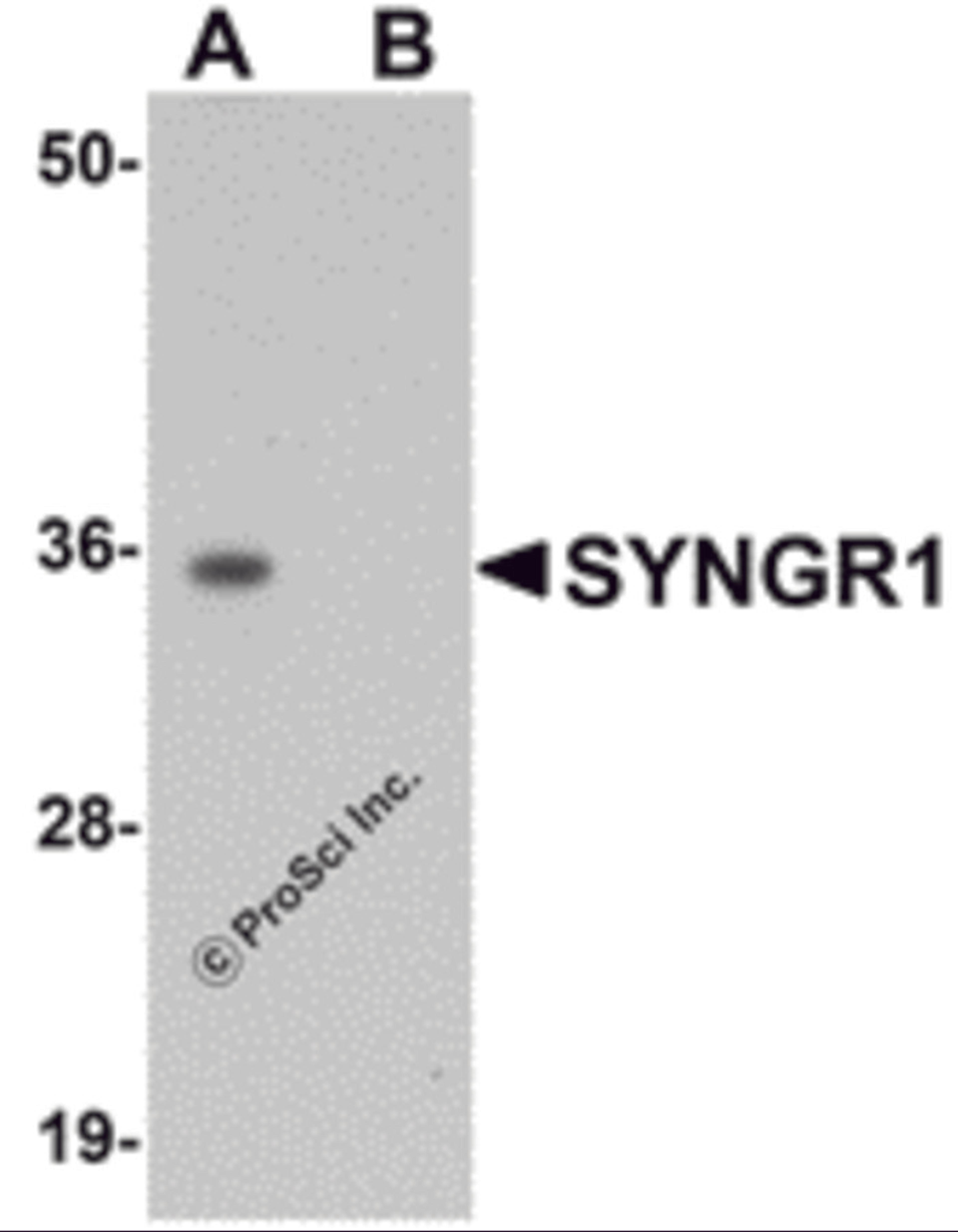 Western blot analysis of SYNGR1 in rat brain tissue lysate with SYNGR1 antibody at 1 μg/mL in (A) the absence and (B) the presence of blocking peptide.