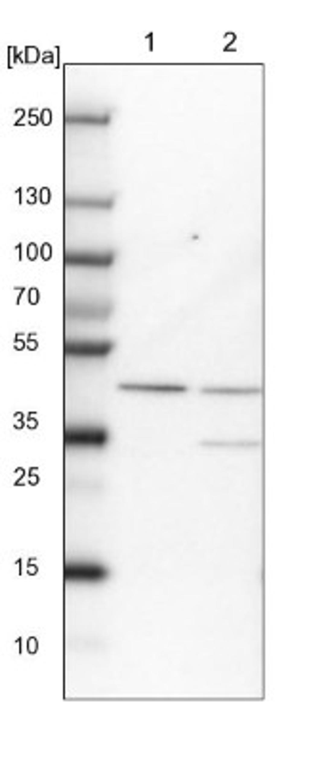 Western Blot: RMND5B Antibody [NBP2-13234] - Lane 1: NIH-3T3 cell lysate (Mouse embryonic fibroblast cells)<br/>Lane 2: NBT-II cell lysate (Rat Wistar bladder tumour cells)