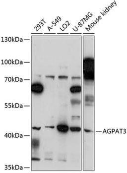 Western blot - AGPAT3 antibody (A14412)