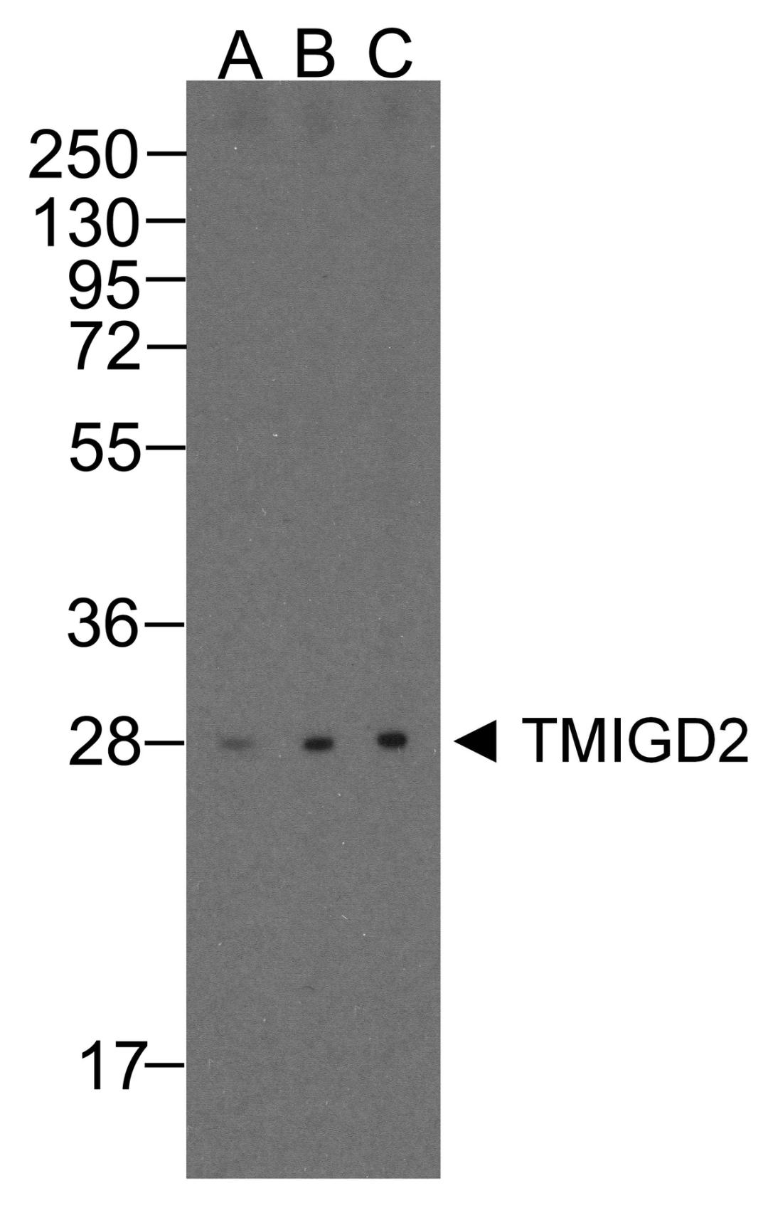 Western blot analysis of TMIGD2 in overexpressing HEK293 cells TMIGD2 antibody at 0.25, 0.5, and 1 μg/ml