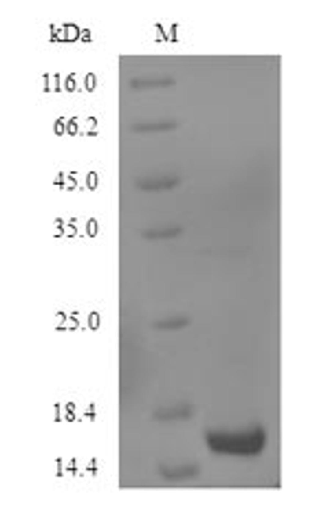 (Tris-Glycine gel) Discontinuous SDS-PAGE (reduced) with 5% enrichment gel and 15% separation gel.