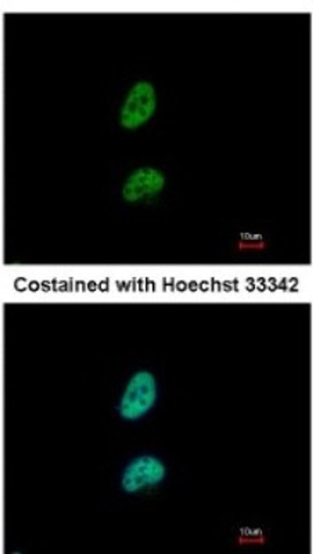 Immunocytochemistry/Immunofluorescence: PSME3 Antibody [NBP1-33498] - Paraformaldehyde-fixed HeLa, using antibody at 1:500 dilution.