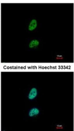 Immunocytochemistry/Immunofluorescence: PSME3 Antibody [NBP1-33498] - Paraformaldehyde-fixed HeLa, using antibody at 1:500 dilution.