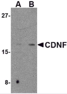 Western blot analysis of CDNF in mouse brain tissue lysate with CDNF antibody at (A) 2 and (B) 4 μg/mL.