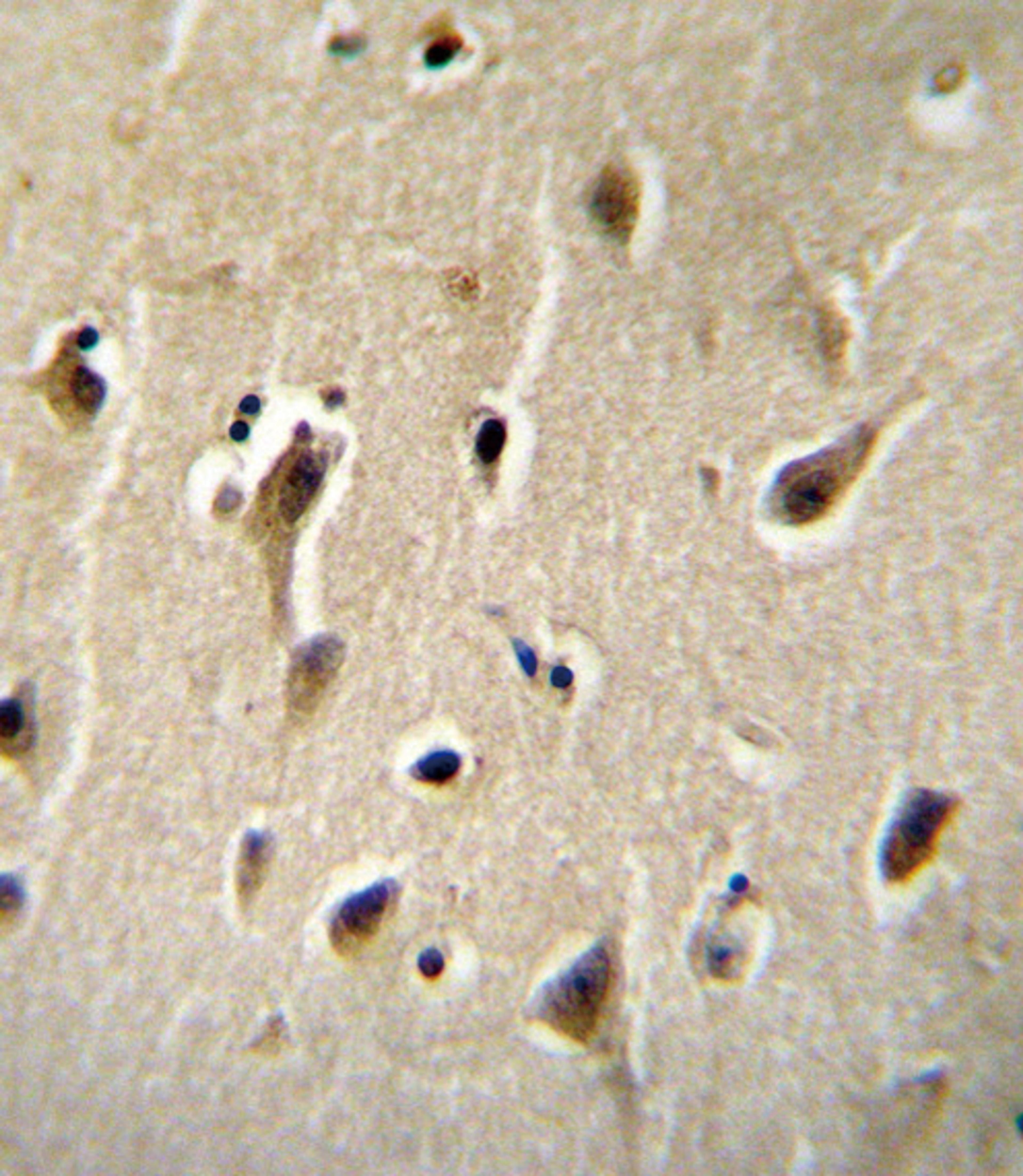 DCK Antibody immunohistochemistry analysis in formalin fixed and paraffin embedded human brain tissue followed by peroxidase conjugation of the secondary antibody and DAB staining.