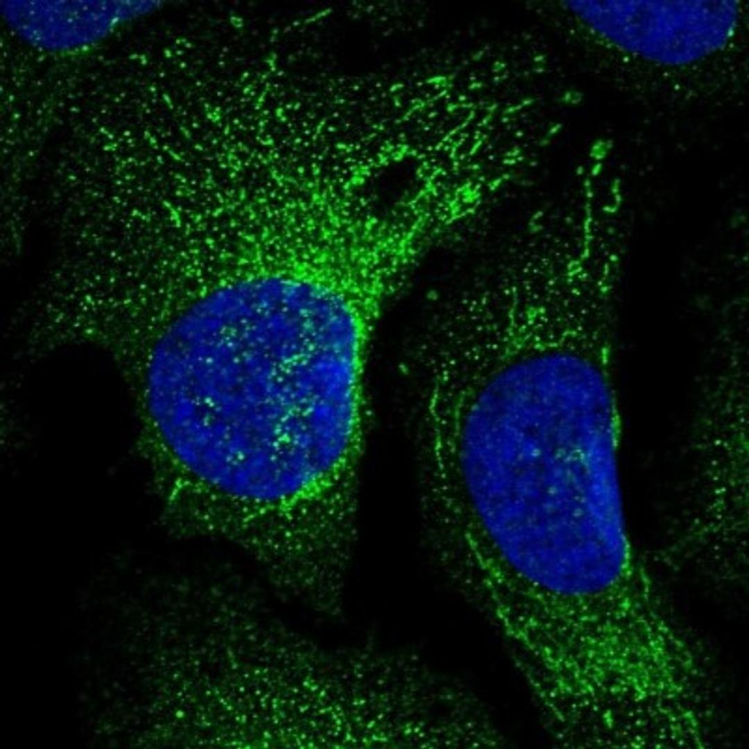 Immunocytochemistry/Immunofluorescence: ARMC8 Antibody [NBP1-85149] - Staining of human cell line U-2 OS shows positivity in mitochondria.