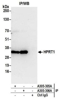 Detection of human HPRT1 by western blot of immunoprecipitates.