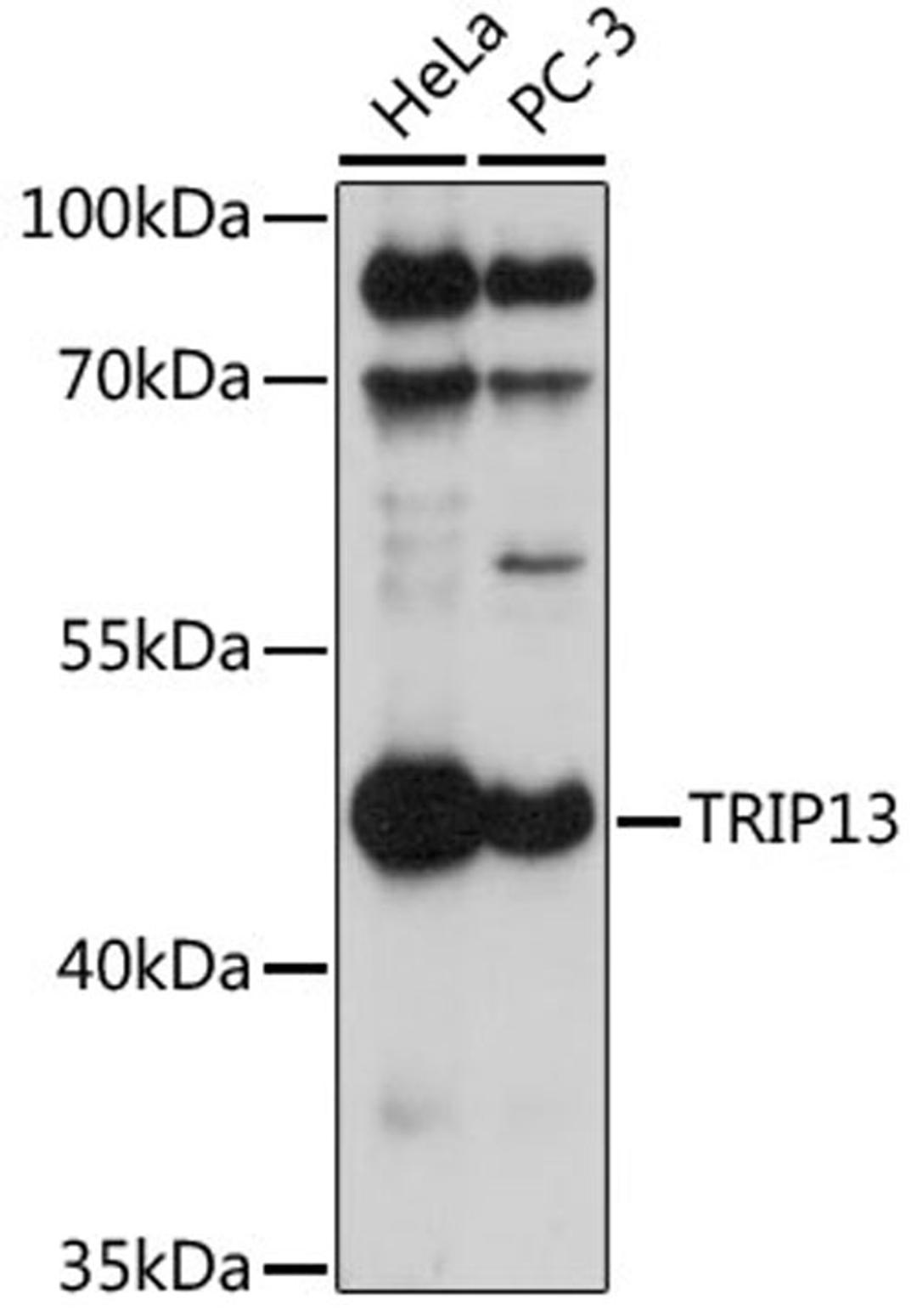 Western blot - TRIP13 antibody (A17357)