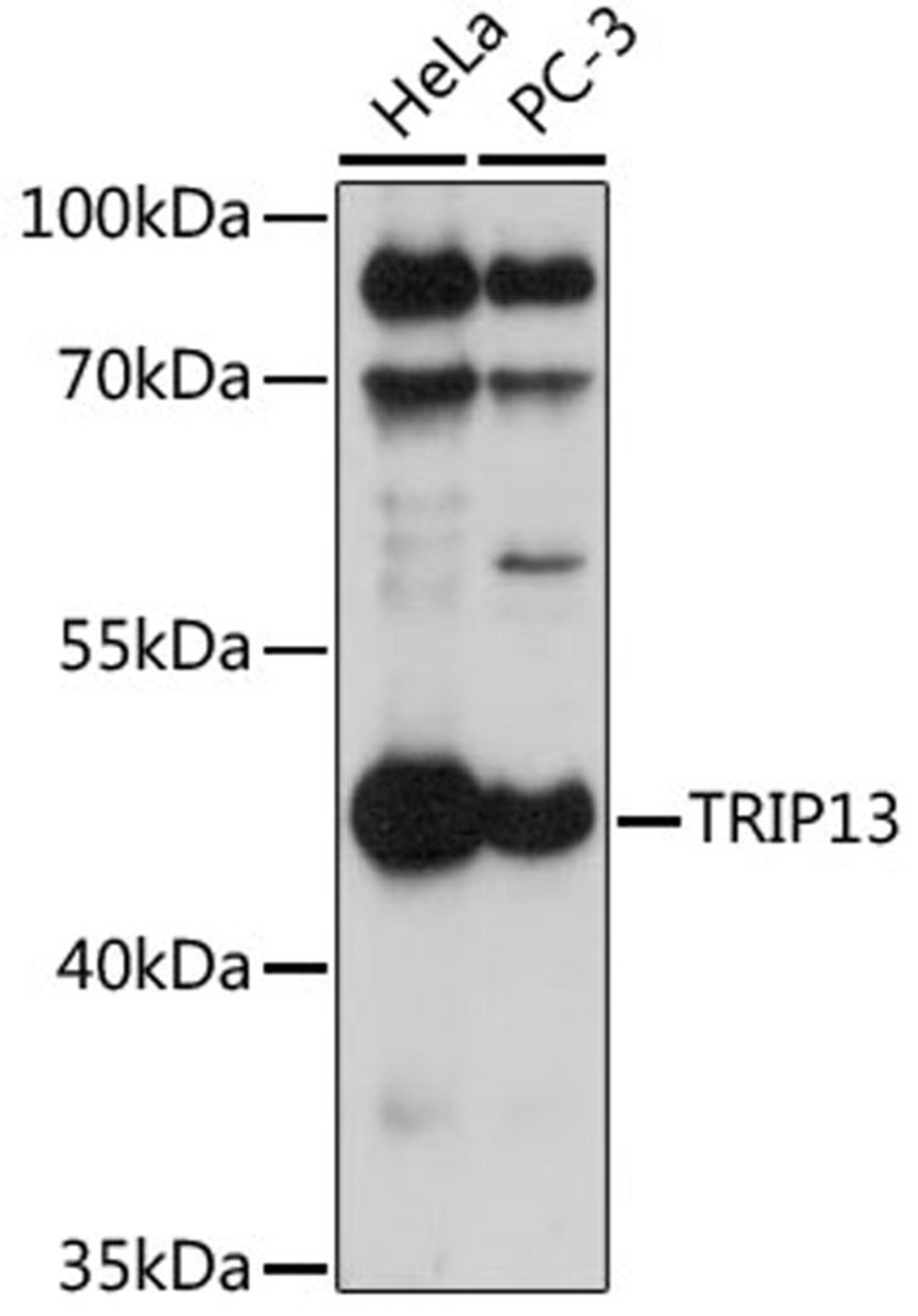 Western blot - TRIP13 antibody (A17357)