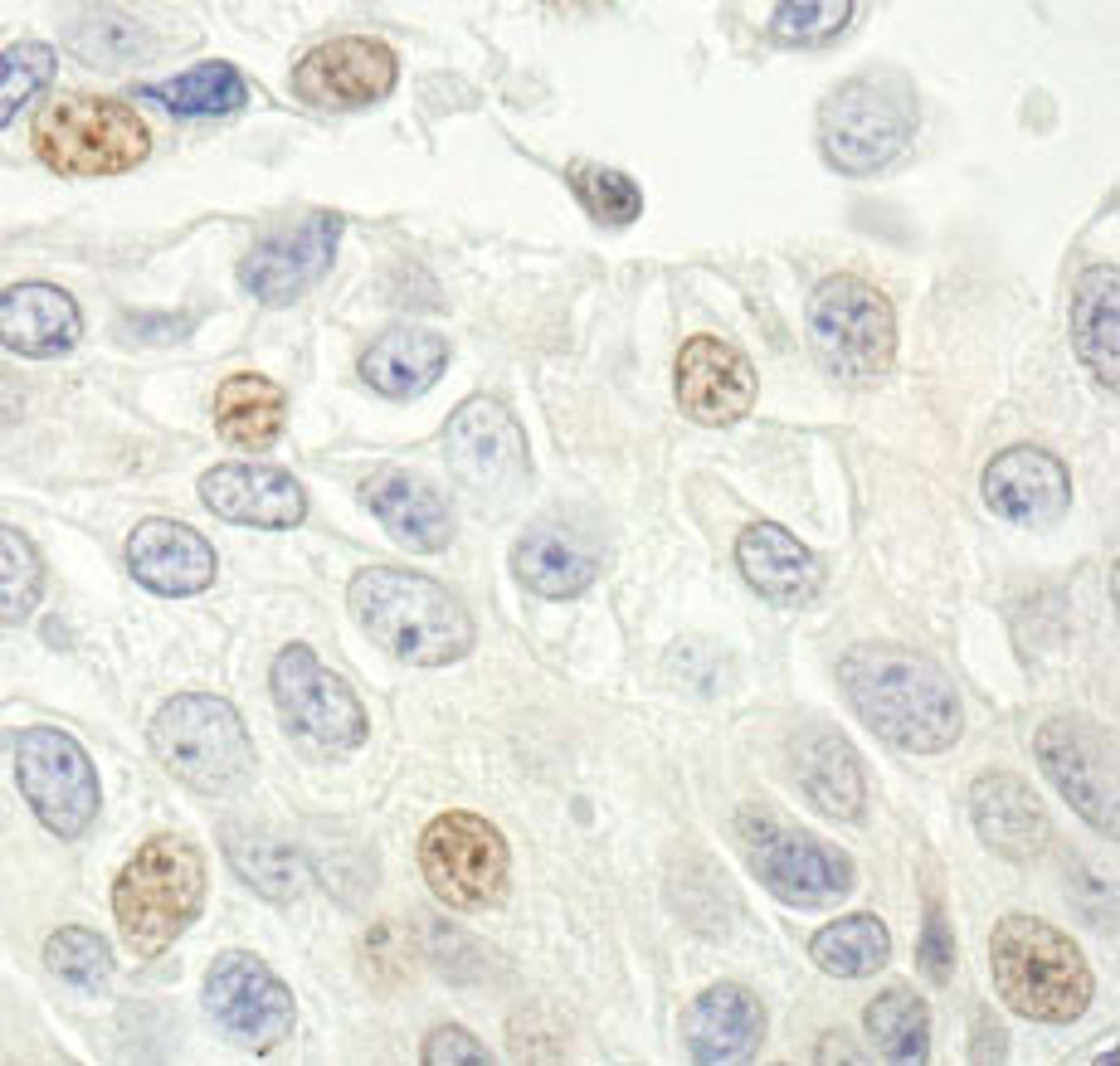 Detection of human p14ARF by immunohistochemistry.