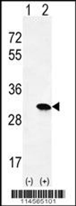 Western blot analysis of HRAS using rabbit polyclonal HRAS Antibody using 293 cell lysates (2 ug/lane) either nontransfected (Lane 1) or transiently transfected (Lane 2) with the HRAS gene.