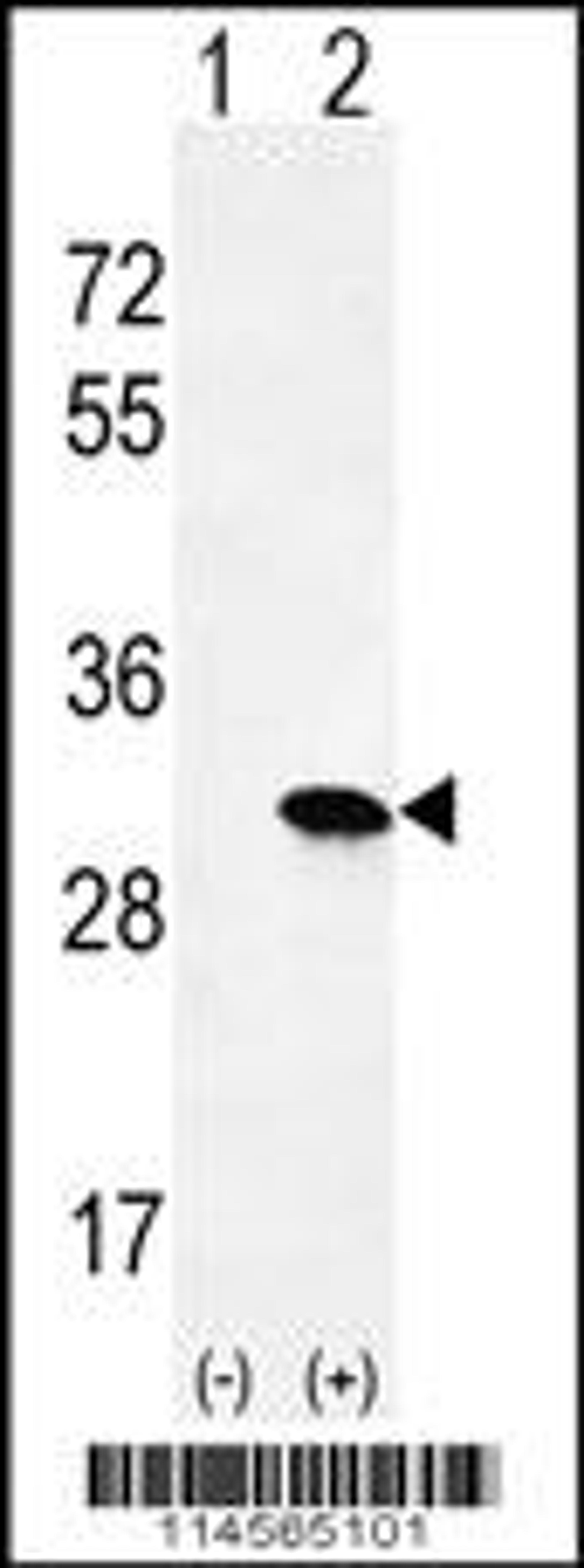 Western blot analysis of HRAS using rabbit polyclonal HRAS Antibody using 293 cell lysates (2 ug/lane) either nontransfected (Lane 1) or transiently transfected (Lane 2) with the HRAS gene.