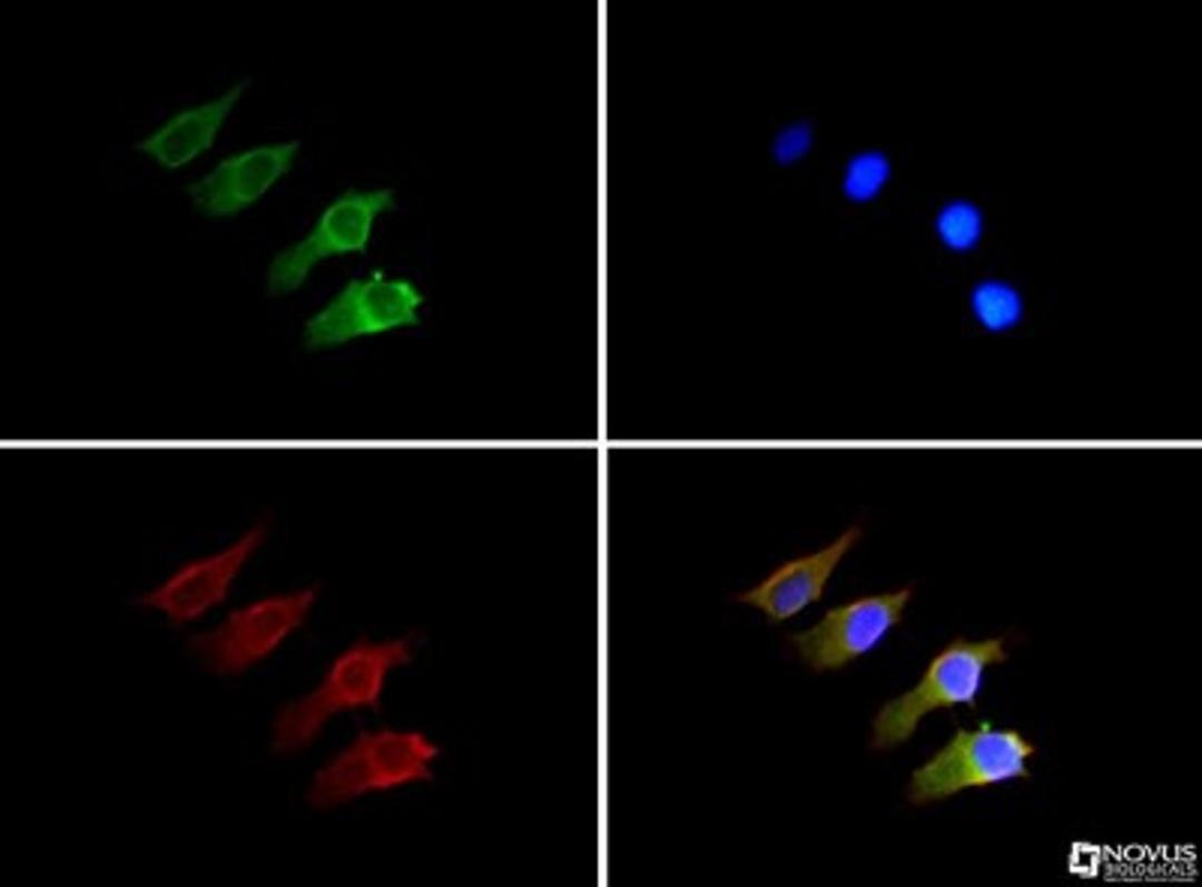 Immunocytochemistry/Immunofluorescence: Semaphorin 3B Antibody [NB100-2218] - SEMA3B antibody was tested in Neuro-2a cells with Dylight 488 (green). Nuclei and alpha-tubulin were counterstained with DAPI (blue) and Dylight 550 (red).