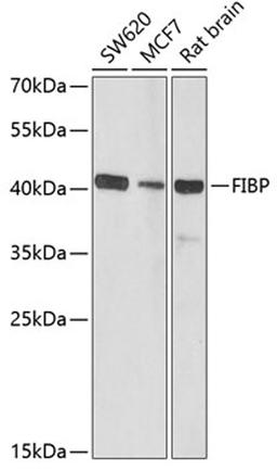 Western blot - FIBP antibody (A6436)