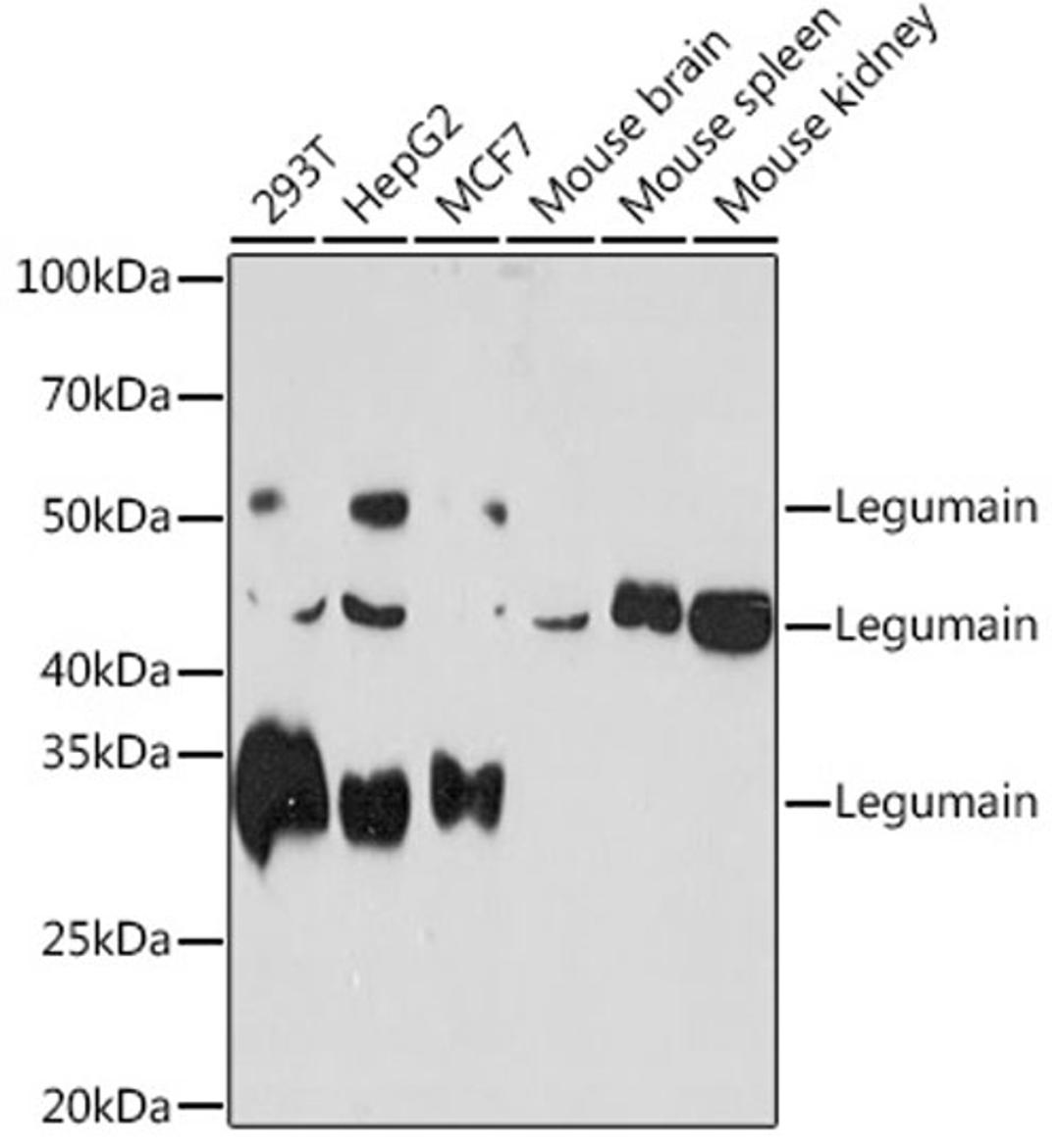 Western blot - Legumain Rabbit mAb (A6829)