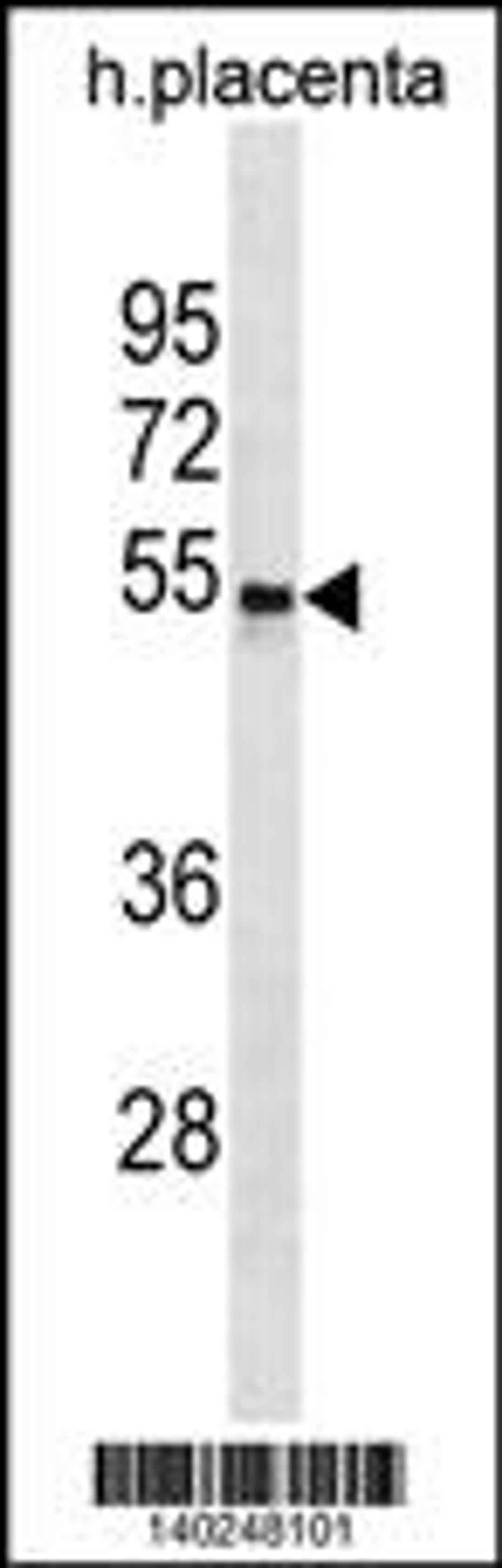 Western blot analysis in human placenta tissue lysates (35ug/lane).