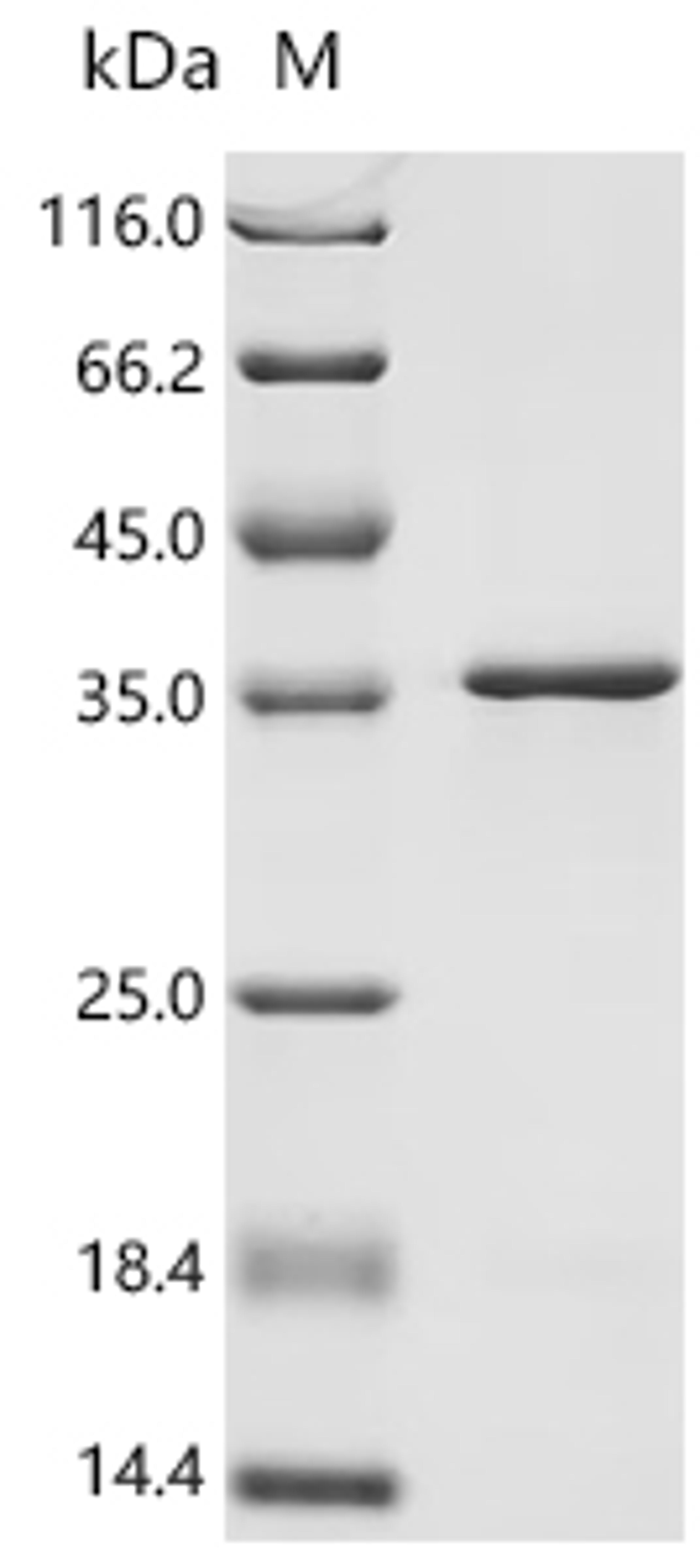 (Tris-Glycine gel) Discontinuous SDS-PAGE (reduced) with 5% enrichment gel and 15% separation gel.