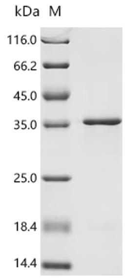 (Tris-Glycine gel) Discontinuous SDS-PAGE (reduced) with 5% enrichment gel and 15% separation gel.