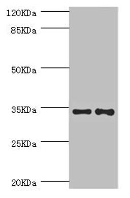 Western blot. All lanes: NRBF2 antibody at 5.51ug/ml. Lane 1: HepG2 whole cell lysate. Lane 2: A549 whole cell lysate. Secondary. Goat polyclonal to rabbit IgG at 1/10000 dilution. Predicted band size: 33, 27, 32 kDa. Observed band size: 33 kDa.