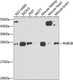 Western blot - RAB1B antibody (A7514)