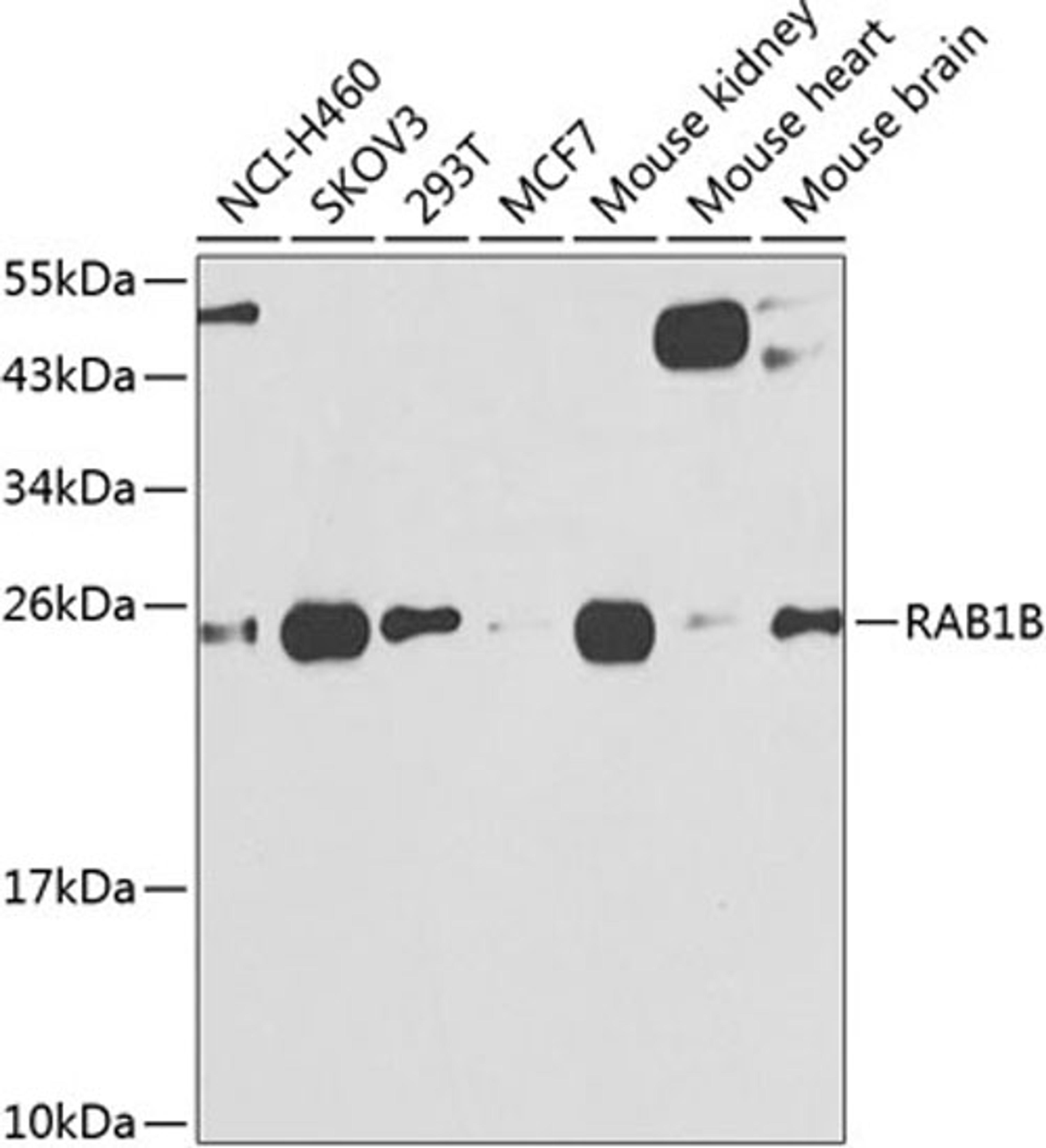 Western blot - RAB1B antibody (A7514)