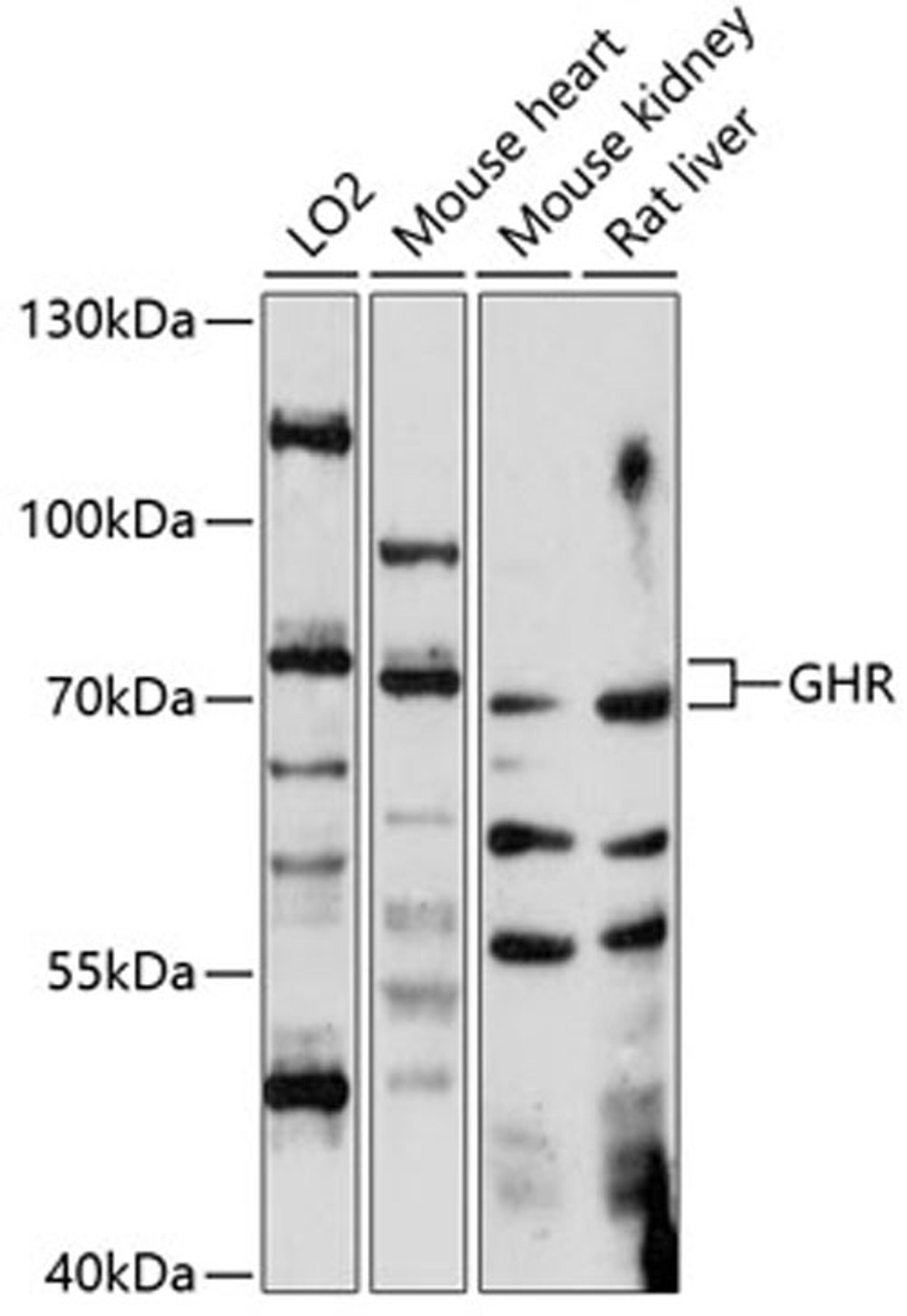 Western blot - GHR antibody (A14735)