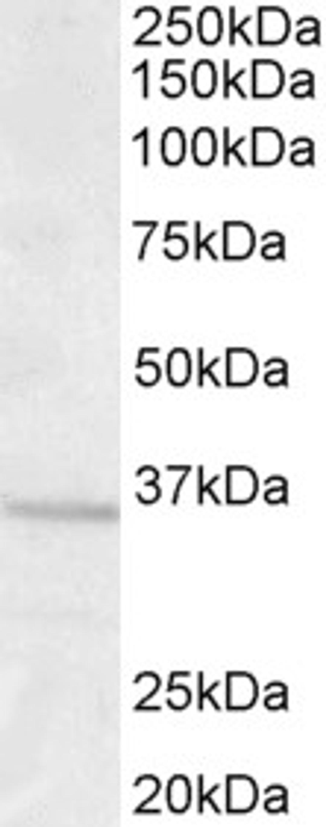 45-683 (1.0ug/ml) staining of Human Brain (Frontal Cortex) lysate (35ug protein in RIPA buffer). Primary incubation was 1 hour. Detected by chemiluminescence.