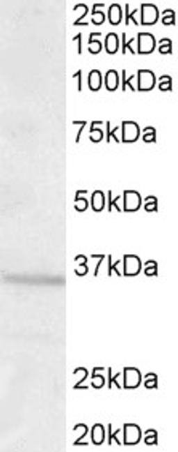 45-683 (1.0ug/ml) staining of Human Brain (Frontal Cortex) lysate (35ug protein in RIPA buffer). Primary incubation was 1 hour. Detected by chemiluminescence.