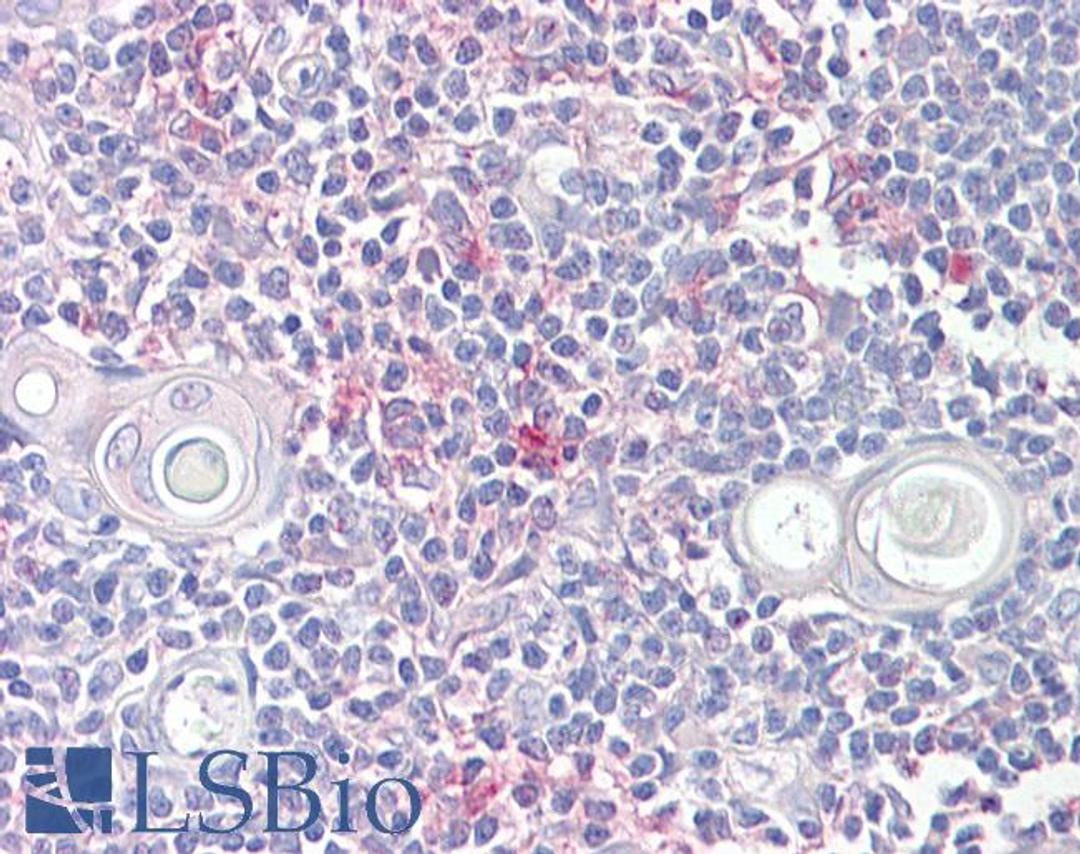 46-681 (6.5ug/ml) staining of paraffin embedded Human Thymus. Steamed antigen retrieval with citrate buffer pH 6, AP-staining.