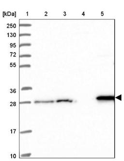 Western Blot: DCI Antibody [NBP1-91822] - Lane 1: Marker [kDa] 250, 130, 95, 72, 55, 36, 28, 17, 10<br/>Lane 2: Human cell line RT-4<br/>Lane 3: Human cell line U-251MG sp<br/>Lane 4: Human plasma (IgG/HSA depleted)<br/>Lane 5: Human liver tissue