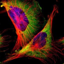 Immunocytochemistry/Immunofluorescence: RPL10 Antibody [NBP1-84037] - Staining of human cell line U-251MG shows positivity in cytoplasm.