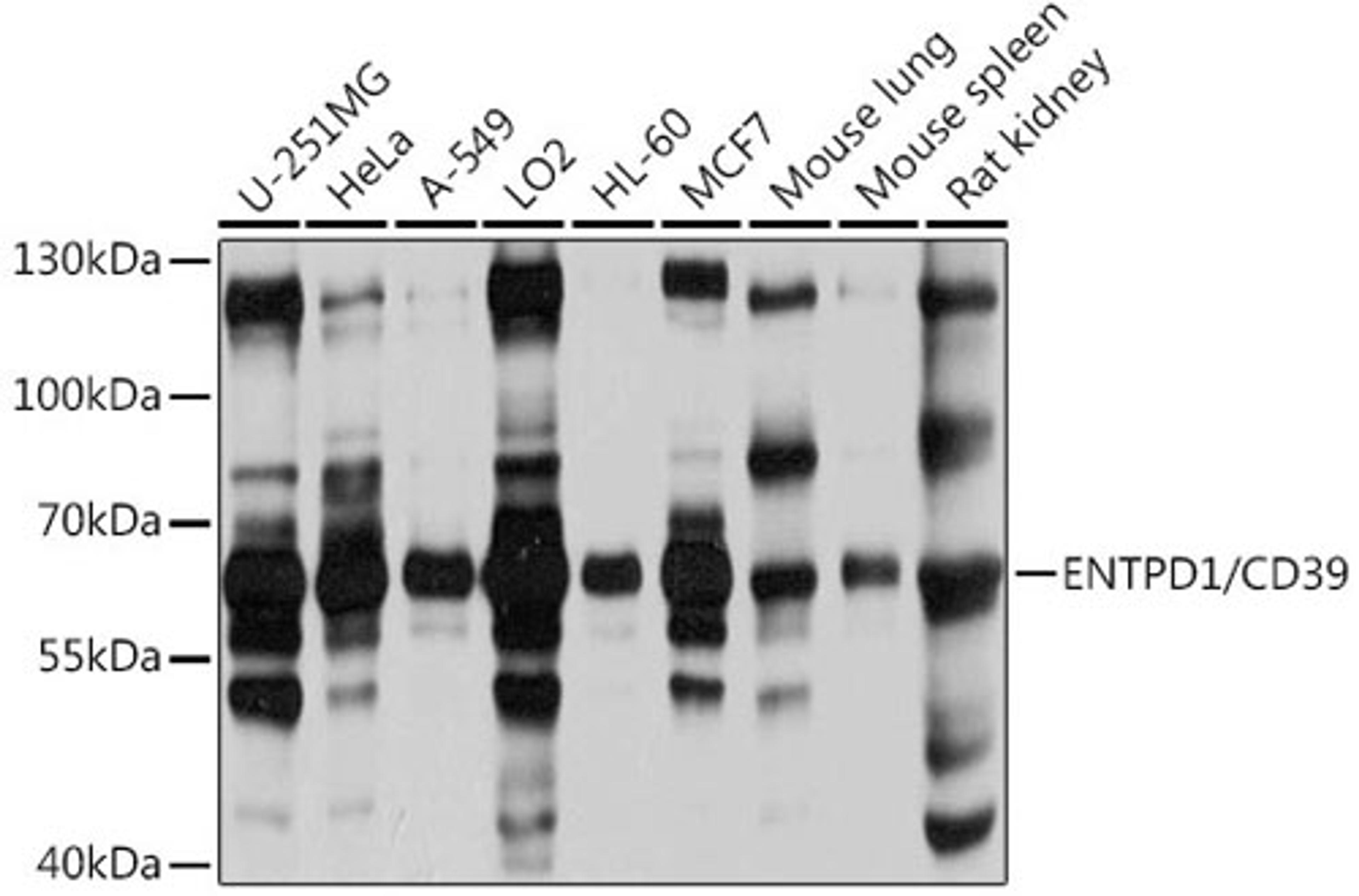 Western blot - ENTPD1/CD39 antibody (A3778)