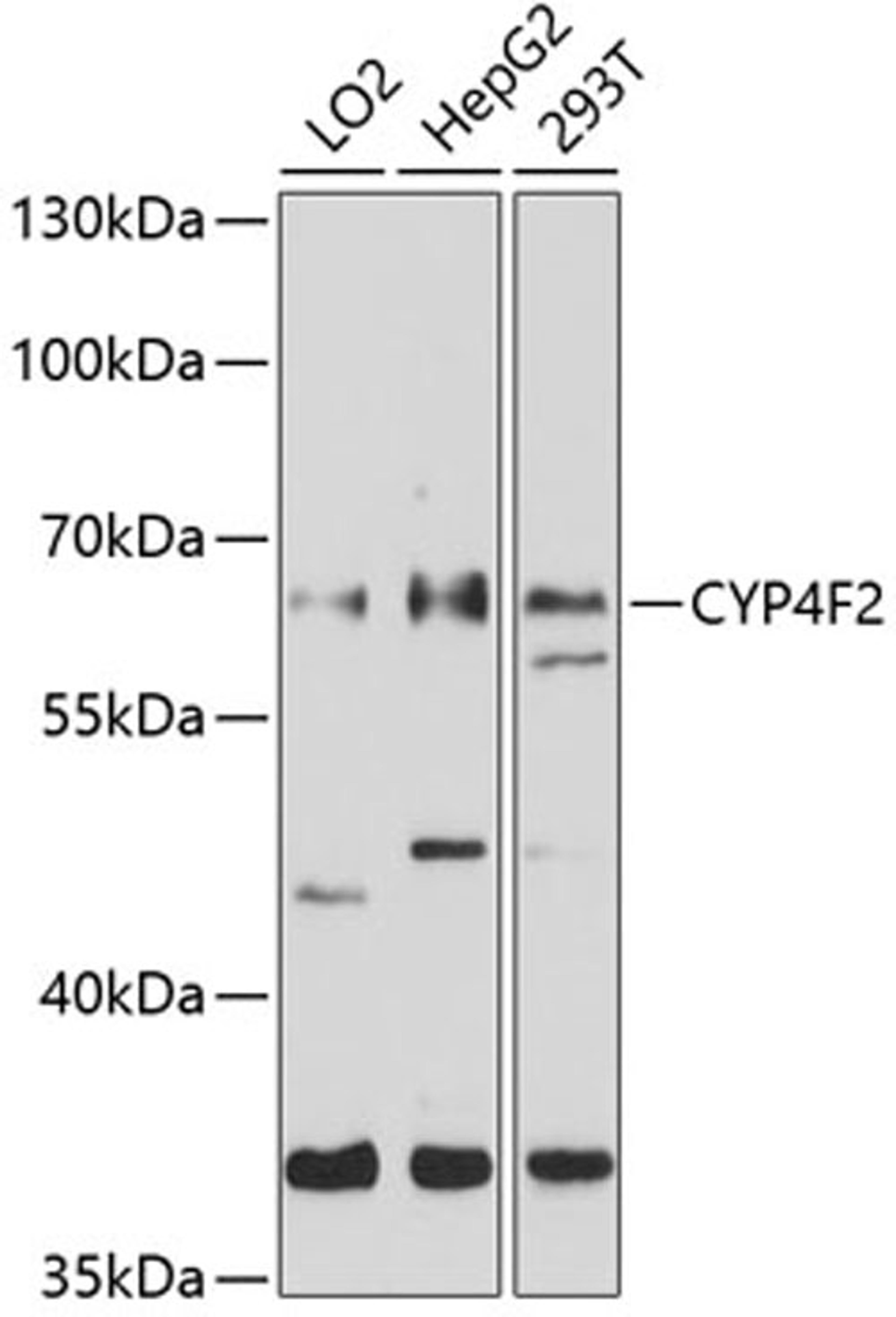 Western blot - CYP4F2 antibody (A10128)