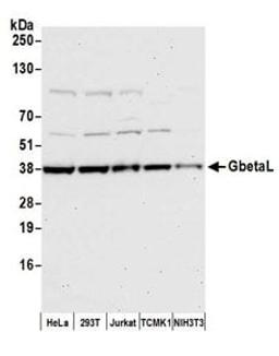 Detection of human and mouse GbetaL by western blot.