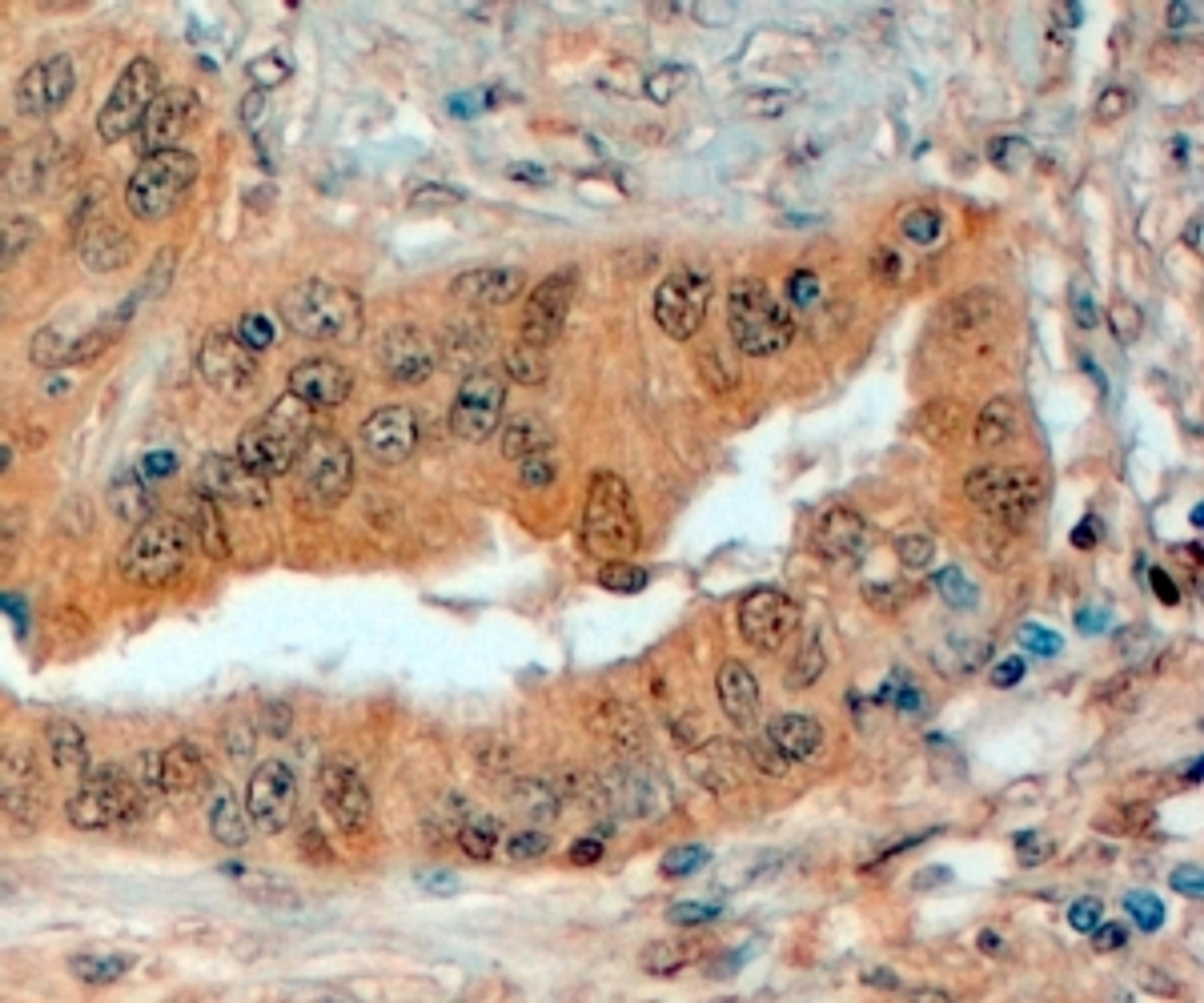 46-348 (4ug/ml) staining of paraffin embedded Human Prostate. Steamed antigen retrieval with citrate buffer pH 6, HRP-staining.